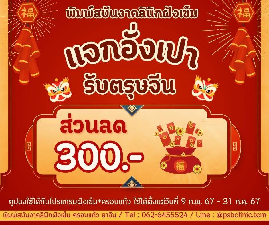 โปรตรุษจีน-ฝังเข็ม